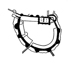 Бресюир. Замок, конец XI в.